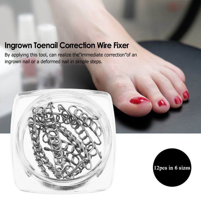 12Pcs/Box Ingrown Toenail Correction Wire Fixer 6 Sizes