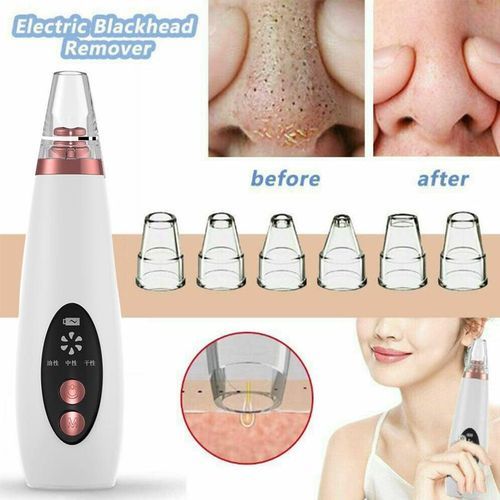 Face Pore Acne Pimple Blackhead Remover Device Rechargeable