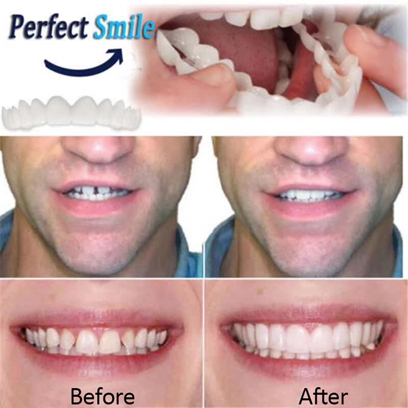3pcs Whitening Fake Tooth Cover Comfort Fit Snap On Beauty
