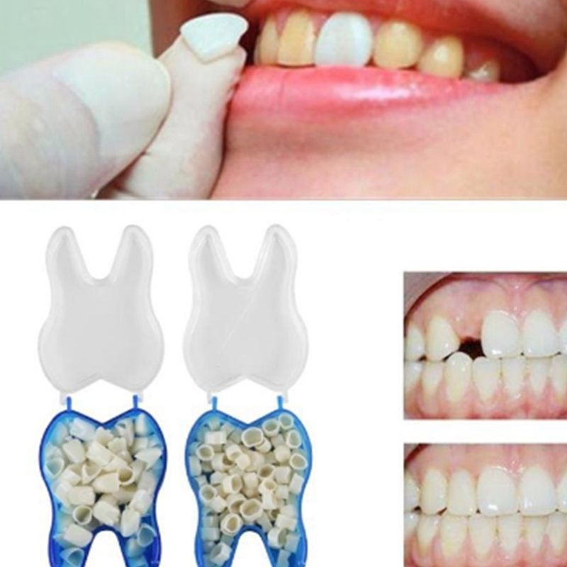 55pcs/box Ultra Thin Dental Crowns Resin Porcelain Veneers