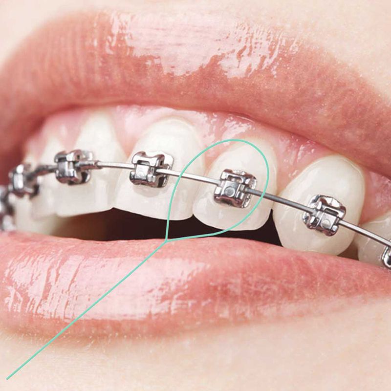 Floss Threader For Crown Brace Bridge Implant 4 Cases 140 6