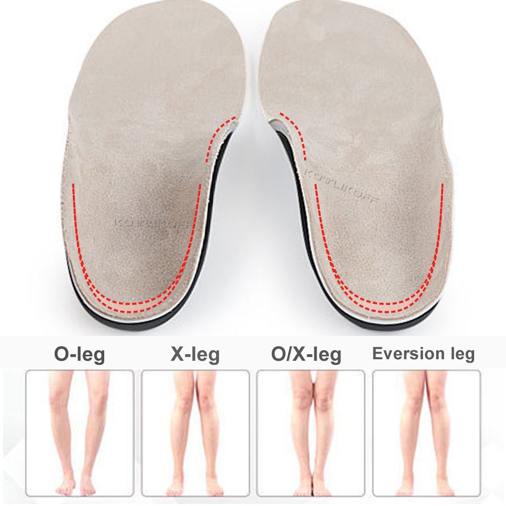 Children Kids Orthopendic Insoles Arch Support For Flat Feet Shoe Pads Insert O/X Type Leg Varus Orthotic Cushion Foot Corrector 1 Pairs