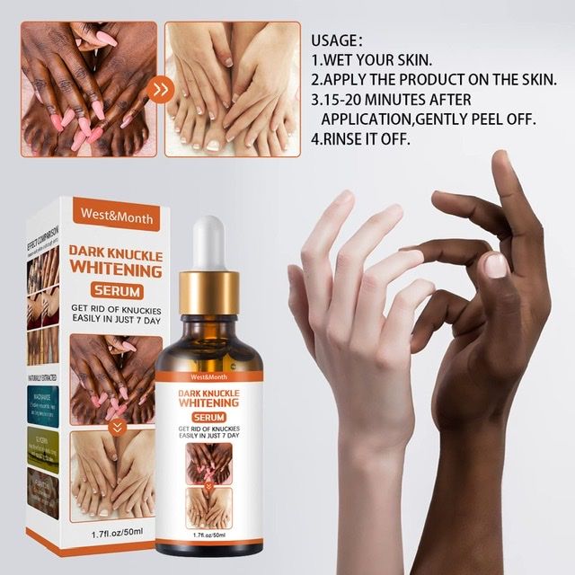 Fast Effective Knuckles And Dark Spot Whitening Serum