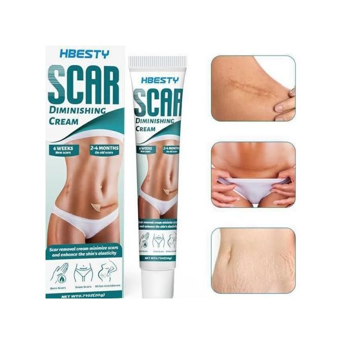 Hibesty Scar Diminishing Cream