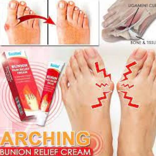 Arthritis Analgesic Herbal Bunion Acid Ointment Relief Cream