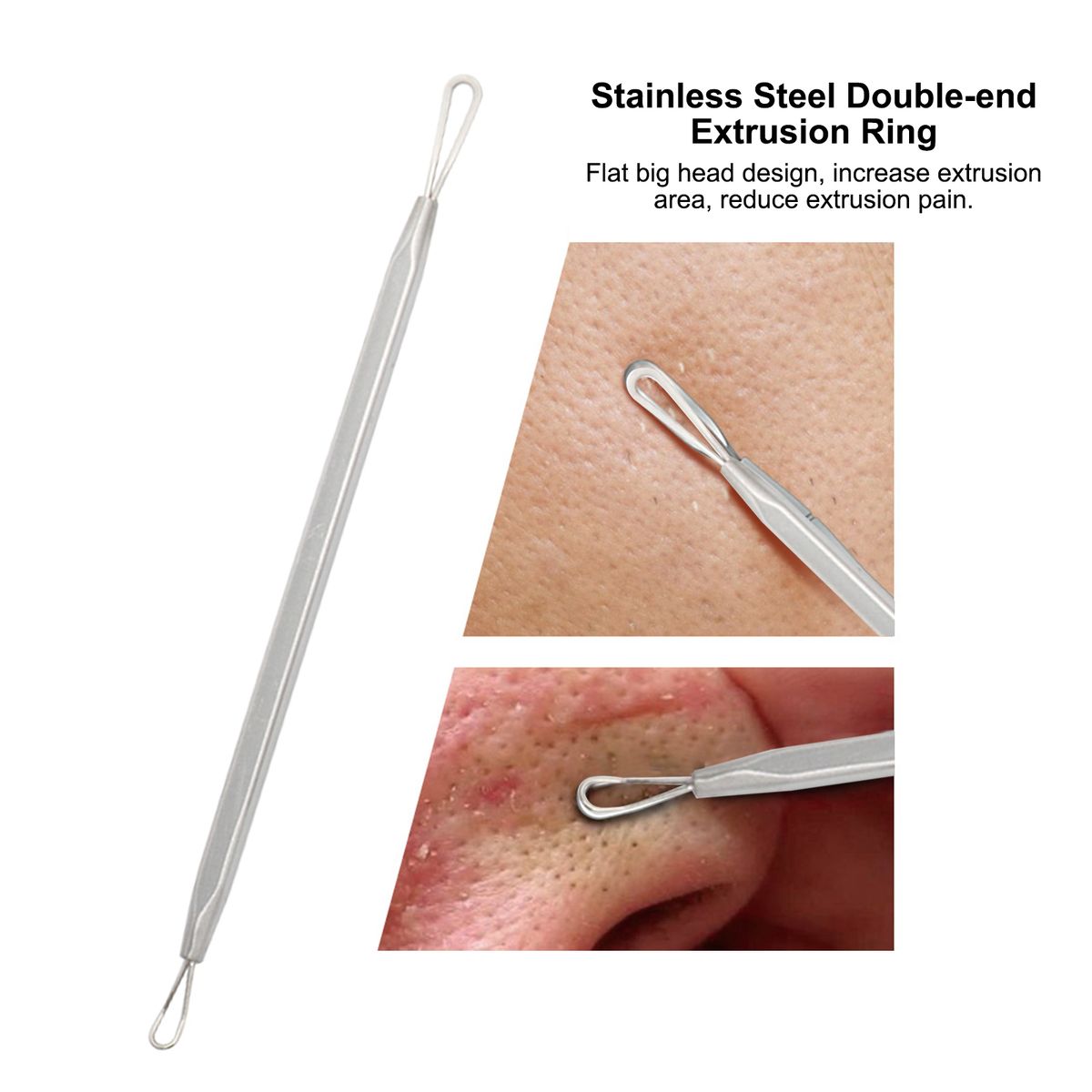 7PCS Pimple Comedone Extractor Tool Acne Removal Kit