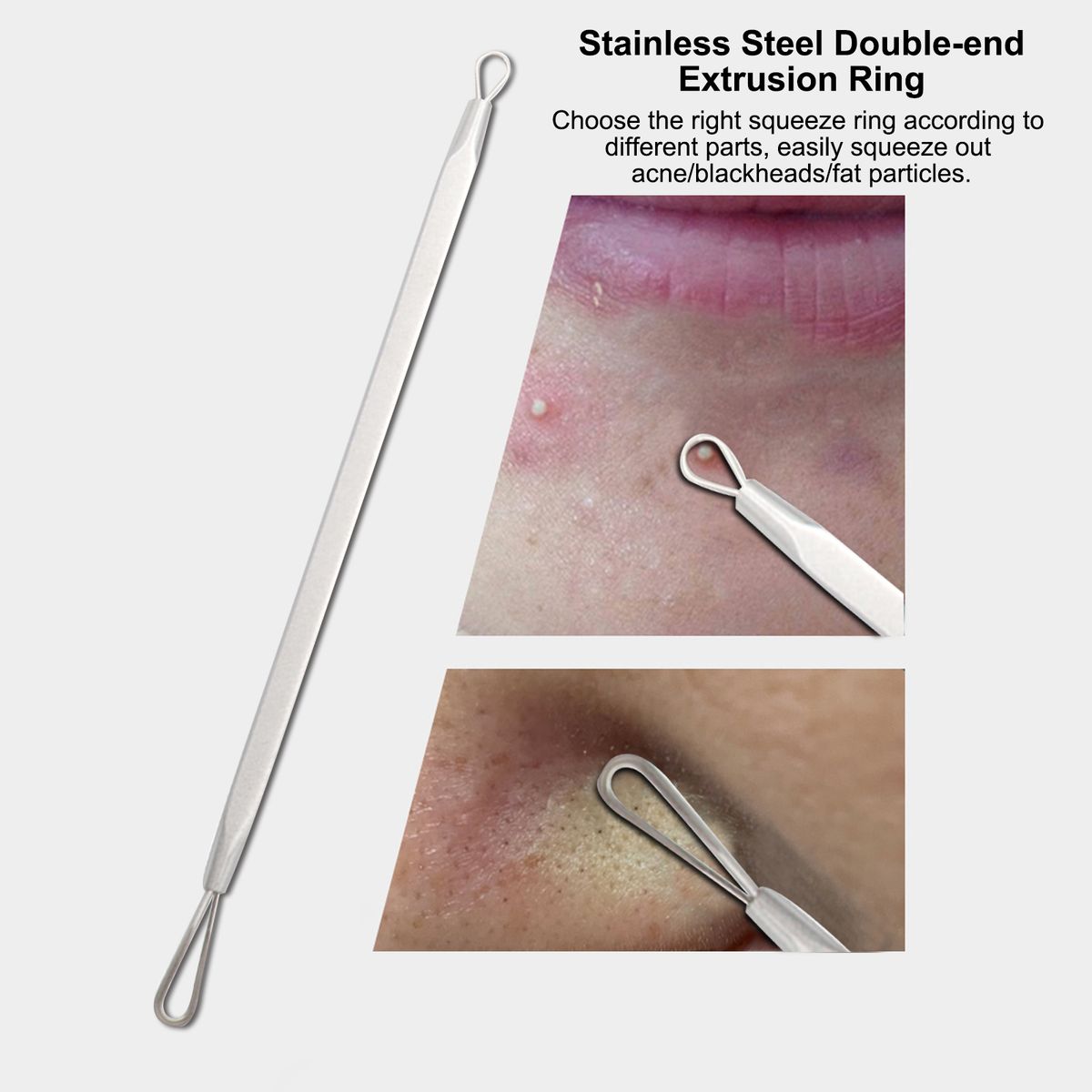 7PCS Pimple Comedone Extractor Tool Acne Removal Kit