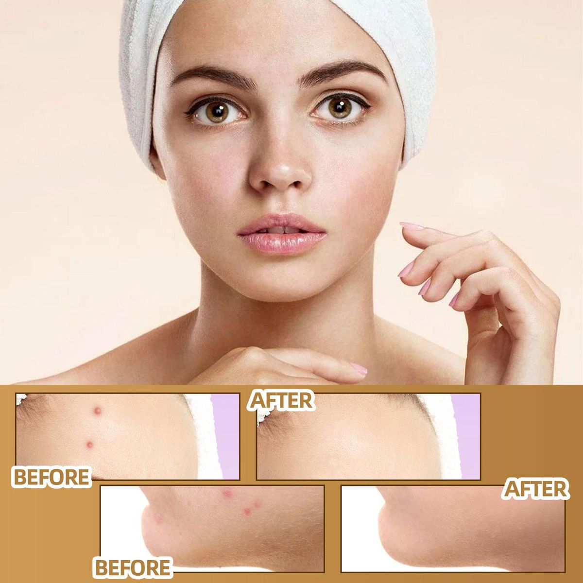 JAYSUING 60 Patches Scar Tattoo Scald Silicone Covering Patch Skin Invisible Concealer Sticker Breathable Comfortable