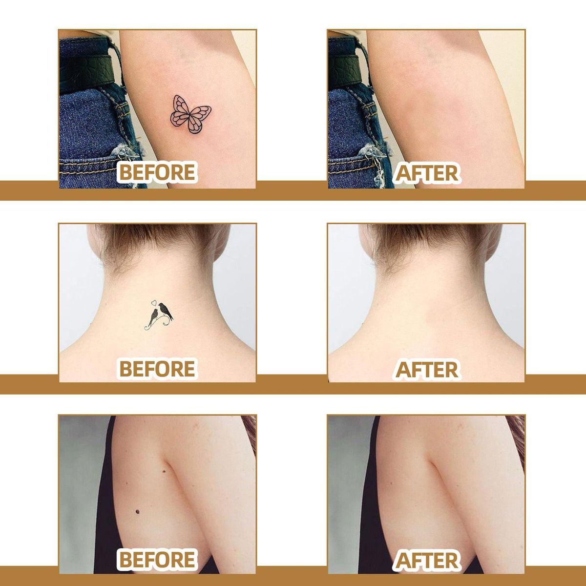 JAYSUING 60 Patches Scar Tattoo Scald Silicone Covering Patch Skin Invisible Concealer Sticker Breathable Comfortable