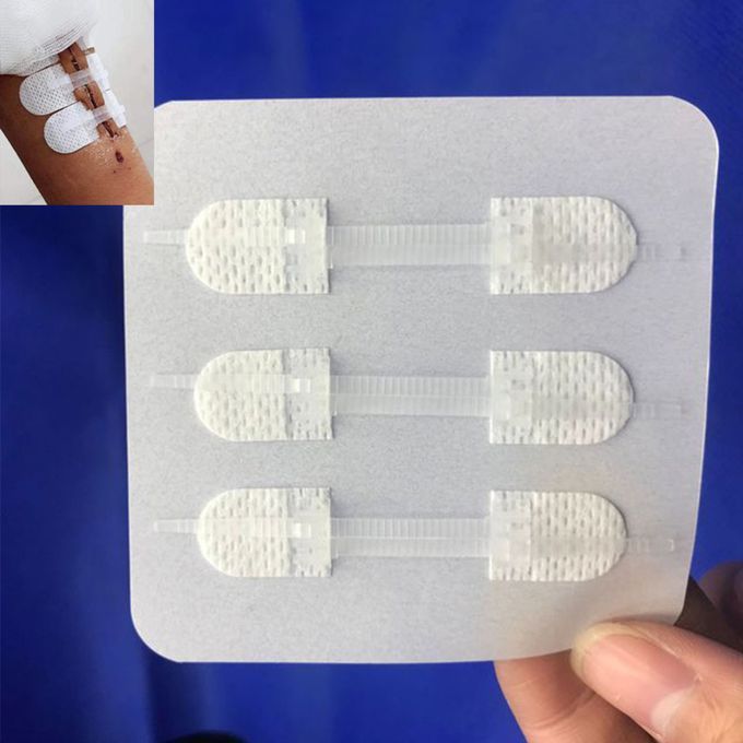 3x Emergency Kit Hemostatic Adhesive Zip Tie Zip Stitches Band