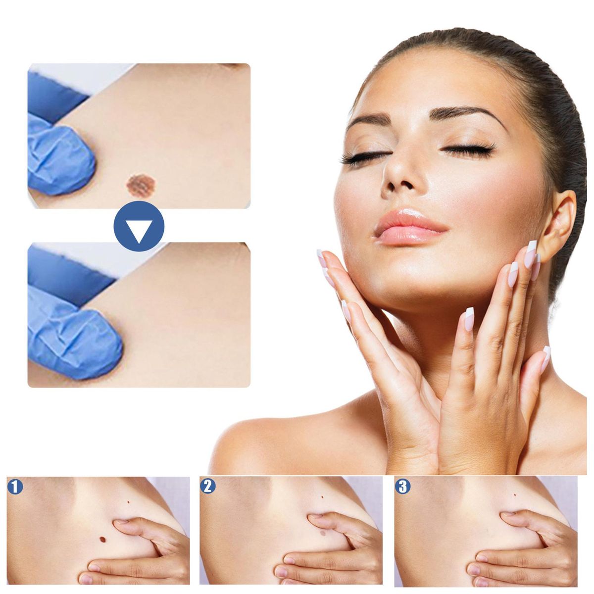 EELHOE Skin T-ag Remover Patches Mole Wart Removing Sticker Natural Ingredients 144PCS
