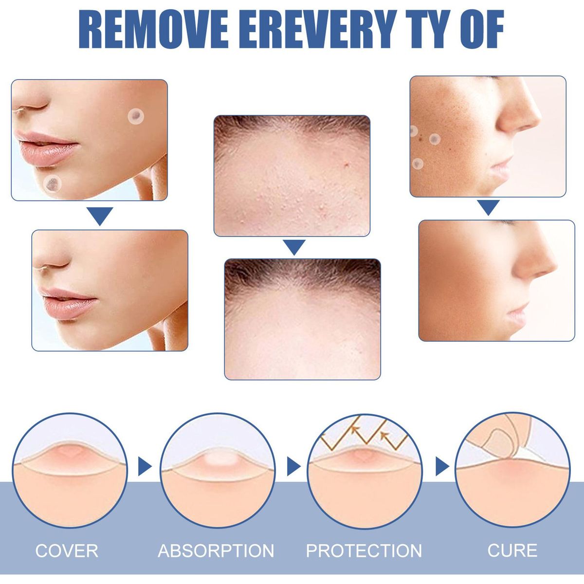 EELHOE Skin T-ag Remover Patches Mole Wart Removing Sticker Natural Ingredients 144PCS