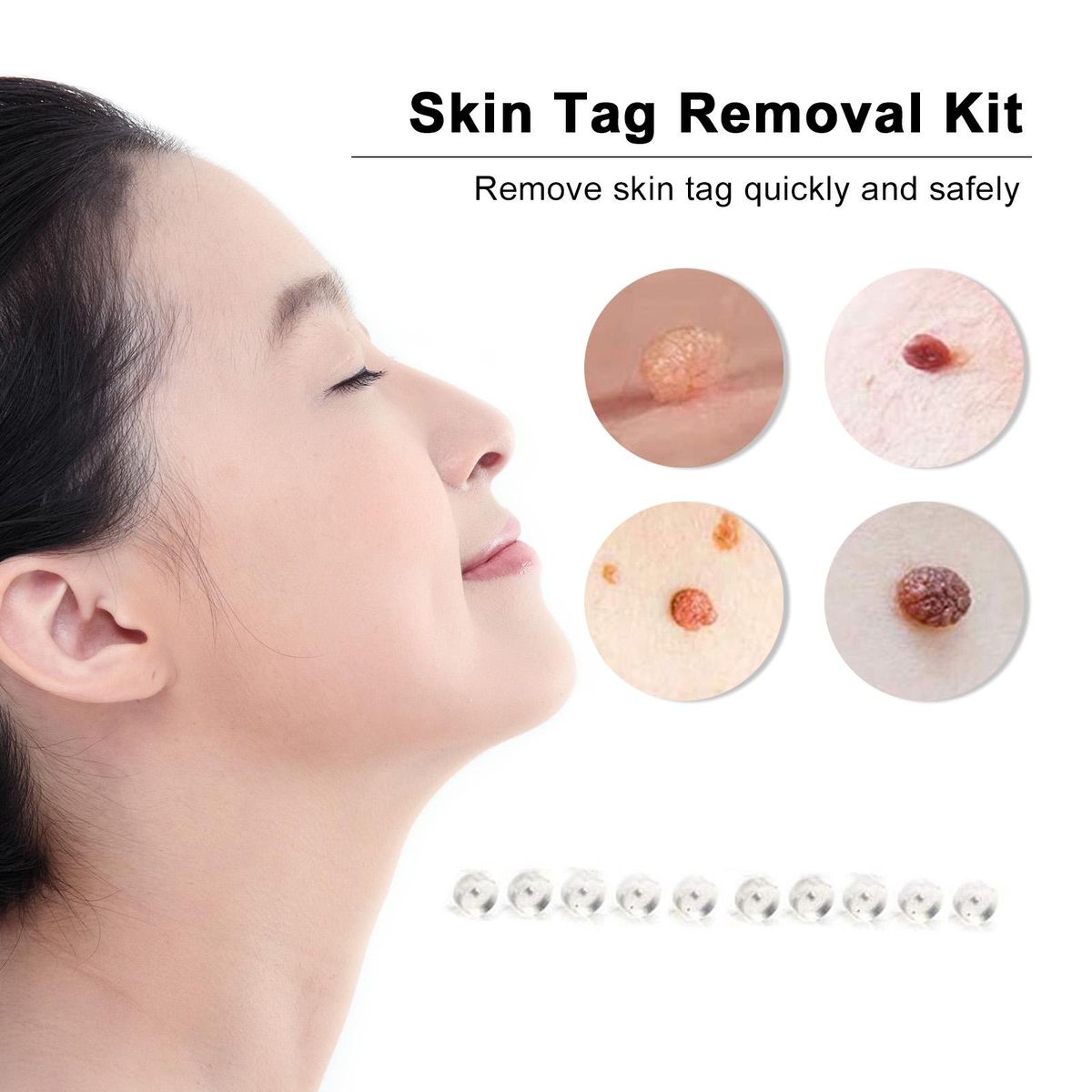 30Pcs Skin Tag Removal Rubber Bands Micro Band Non Toxic Face Care Mole Wart Skin Care Tools