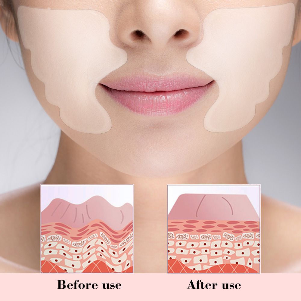 Facial Skin Care Pads Silicone Forehead   Smile Anti-Wrinkle