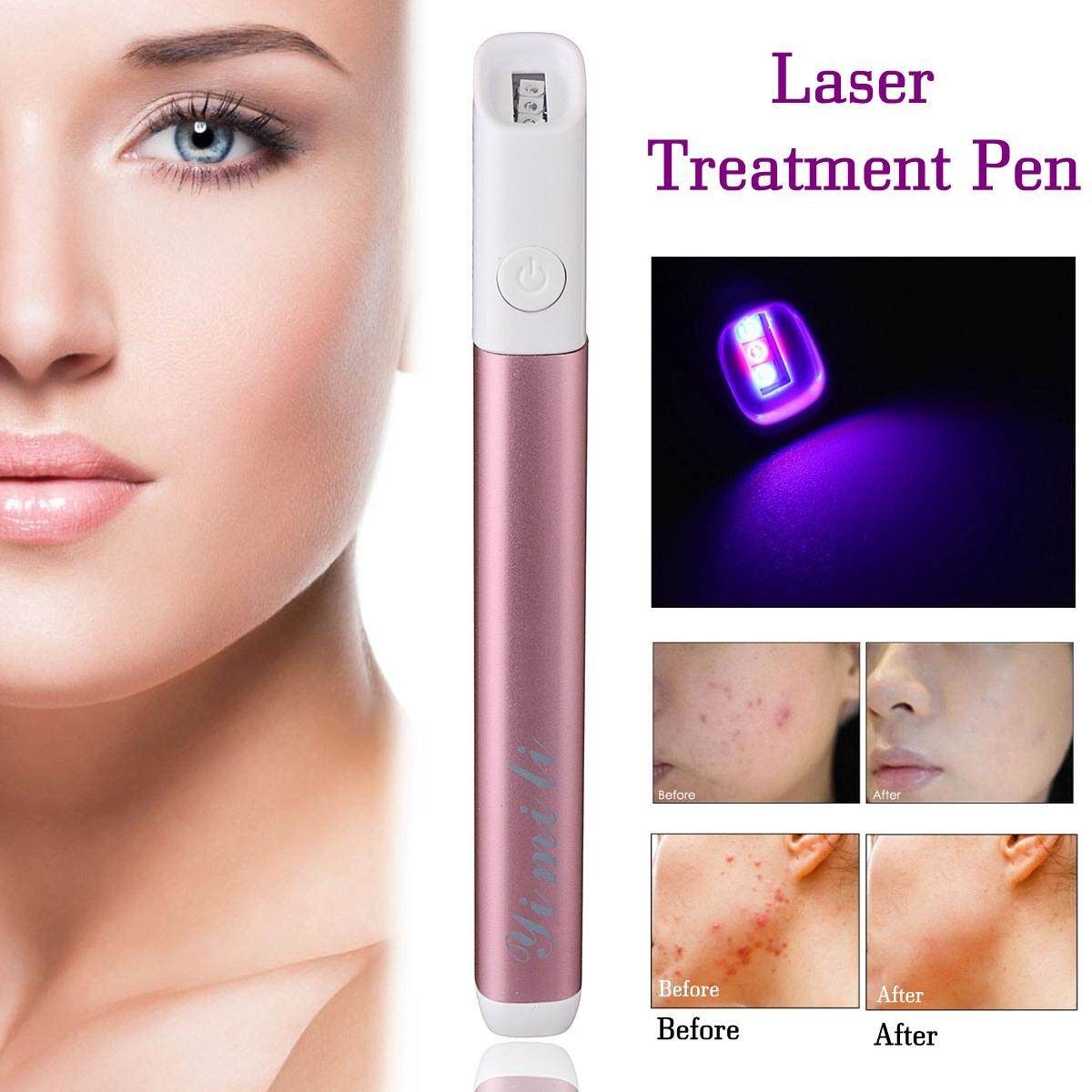 Blue Light Therapy Laser Treatment Pen Scar Wrinkle Removal Device