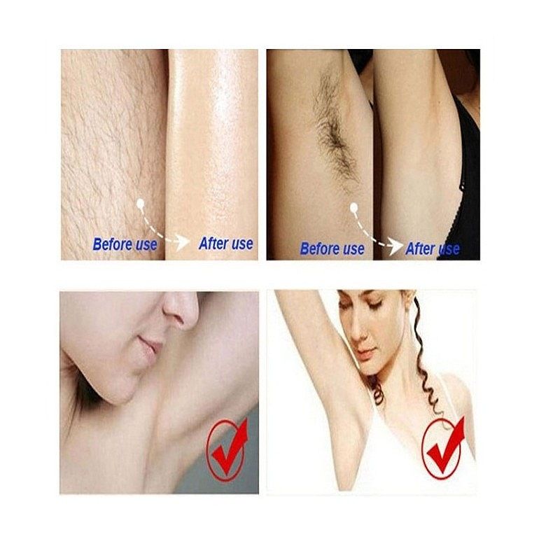 Dr.Rashel Hair Remover Cream. 5 Mins Easy Painless Hair Removing For Body & Leg Without Irritation