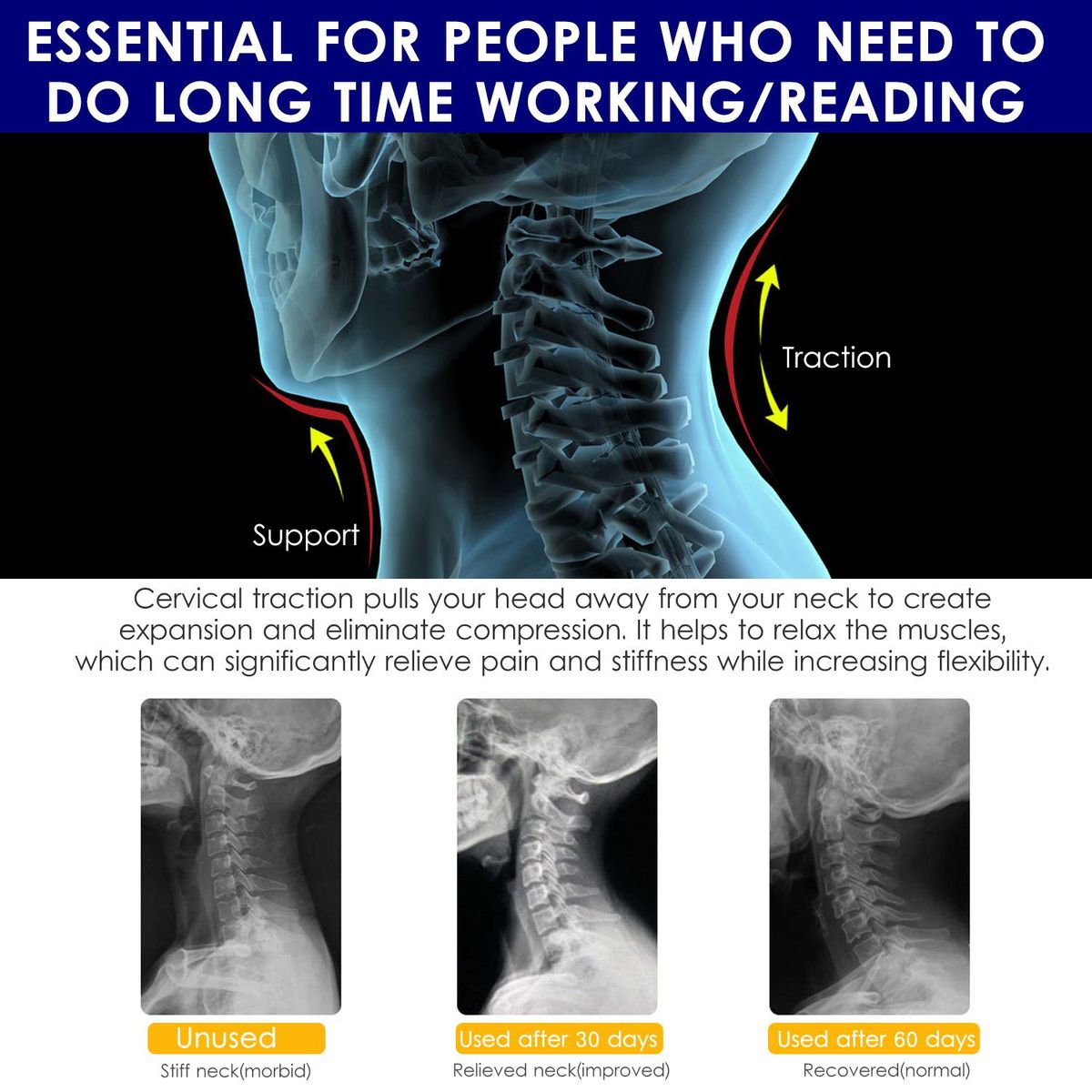 KKmoon Inflatable Medical Neck Cervical Traction Device Relief Neck and Upper Back Pain Portable Home Use Cervical Vertebra Tractor