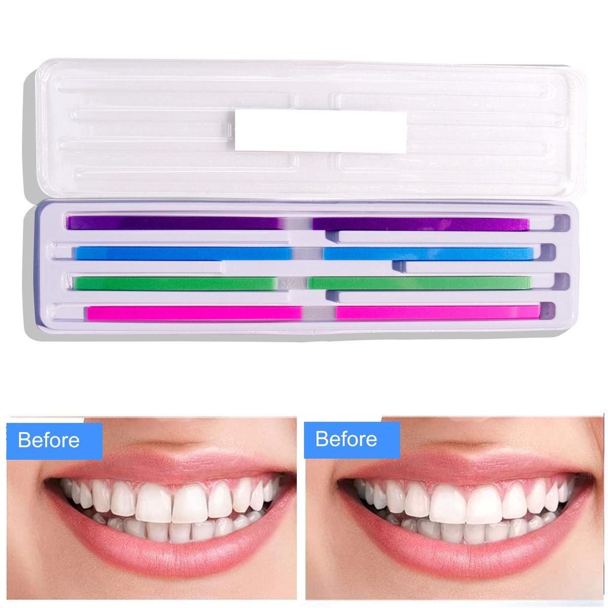 60Pcs/Pack Dental Polishing Strips Teeth Polishing Finishing Kit Interdental Sanding Tool Tooth Sandpaper