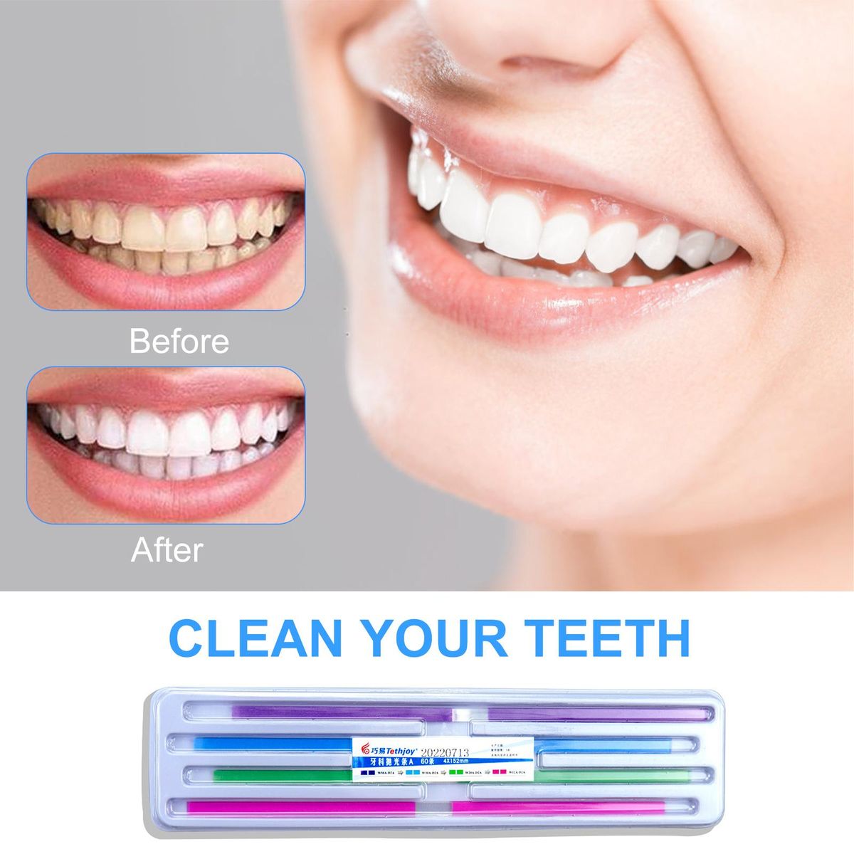 60Pcs/Pack Dental Polishing Strips Teeth Polishing Finishing Kit Interdental Sanding Tool Tooth Sandpaper