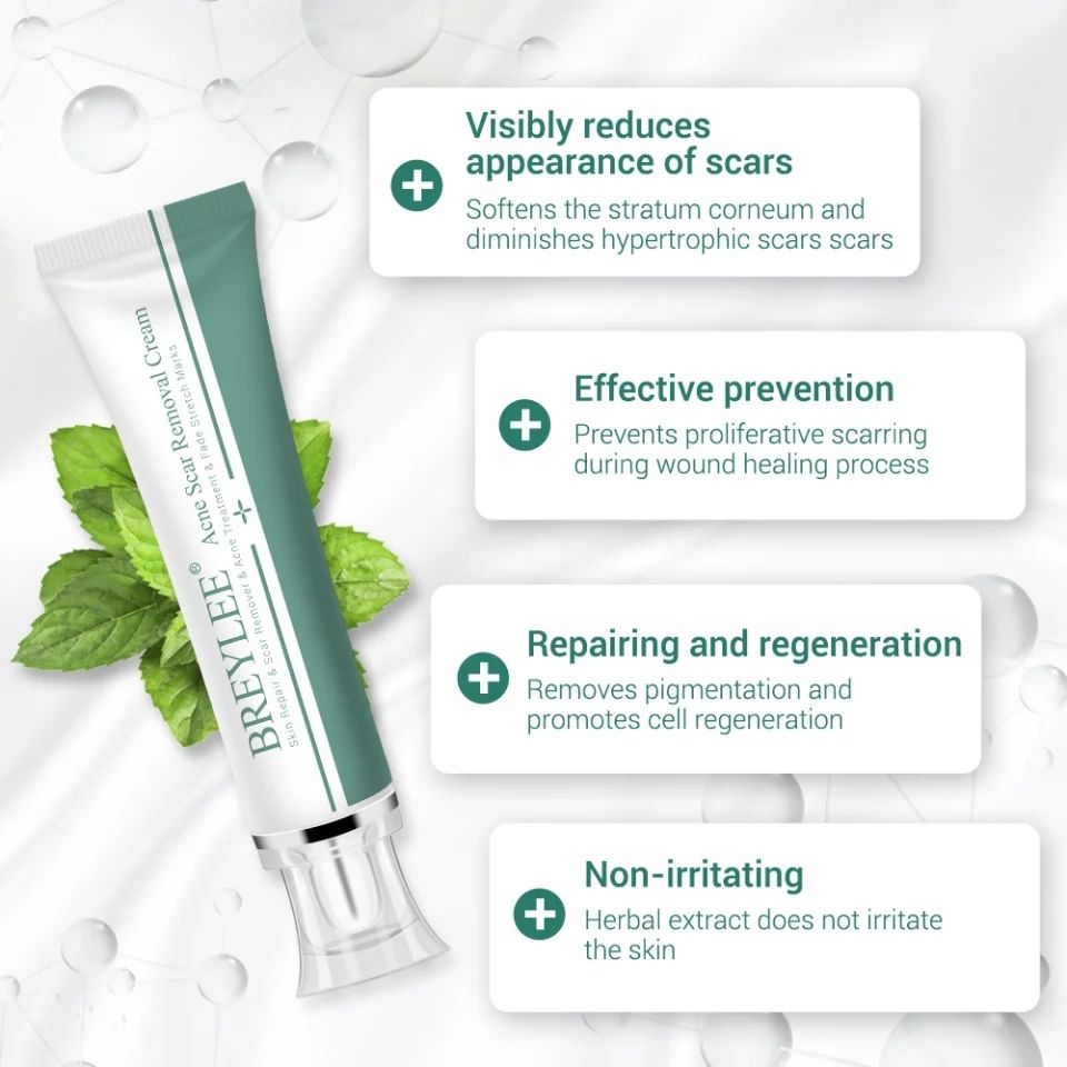 Breylee Acne Scar Removal Cream. - Skin Repair And Scar Remover / Acne Treatment / Stretch Mark Cream