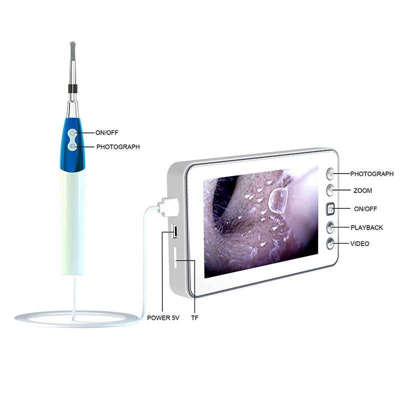 Digital Ear Care Visual Endoscope Camera 1.3MP 4.3 Inch LCD Display Po Video Otoscope 3.9mm/4.3mm Lens 6 LED Ear Clean Spoon-4.3mm