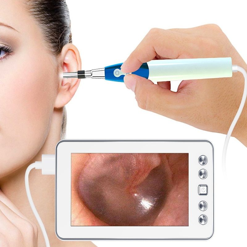 Digital Ear Care Visual Endoscope Camera 1.3MP 4.3 Inch LCD Display Po Video Otoscope 3.9mm/4.3mm Lens 6 LED Ear Clean Spoon-4.3mm