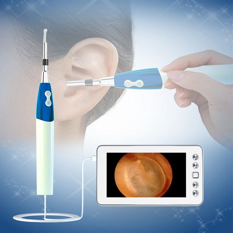 Digital Ear Care Visual Endoscope Camera 1.3MP 4.3 Inch LCD Display Po Video Otoscope 3.9mm/4.3mm Lens 6 LED Ear Clean Spoon-4.3mm