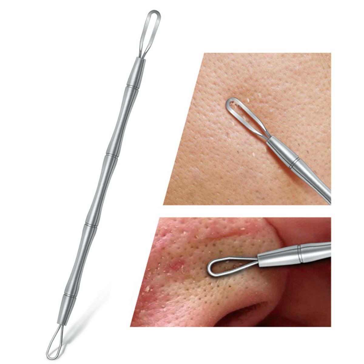 3x  Tool For Blemish Whitehead Zit Popper For Forehead Yellow