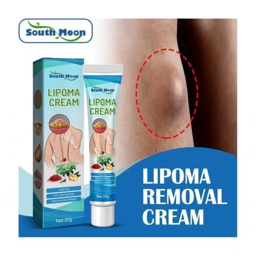 SOUTH MOON Fast Lipoma Removal Cream