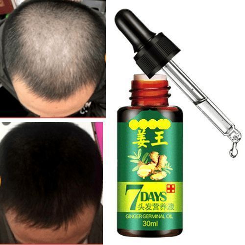 Gluta Magic Acid Hair Growth Oil (7days Hair Tonic)