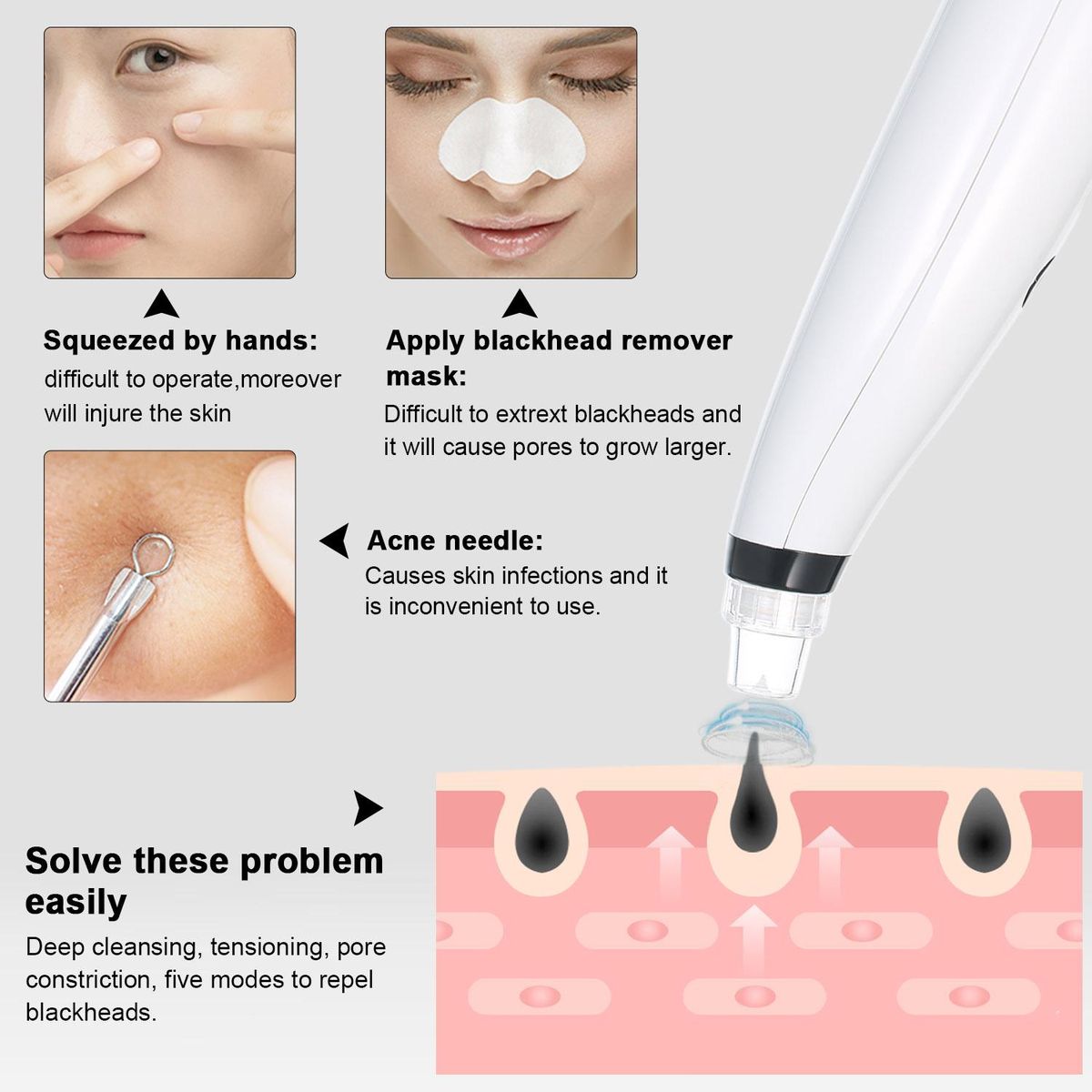Portable Blackhead Remover Electric Blackhead Suction Device with 6 Suction Probes and 5 Adjustable Suction Force 5PCs Acne Removing Tools -USB Rechargeable