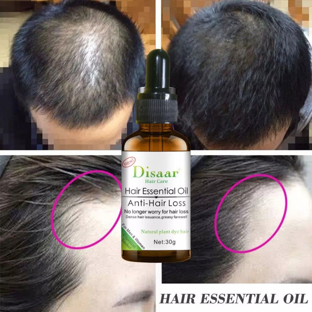 Disaar 30ml Anti-hair Loss Bald Head, Edge ,Beard Growth Oil