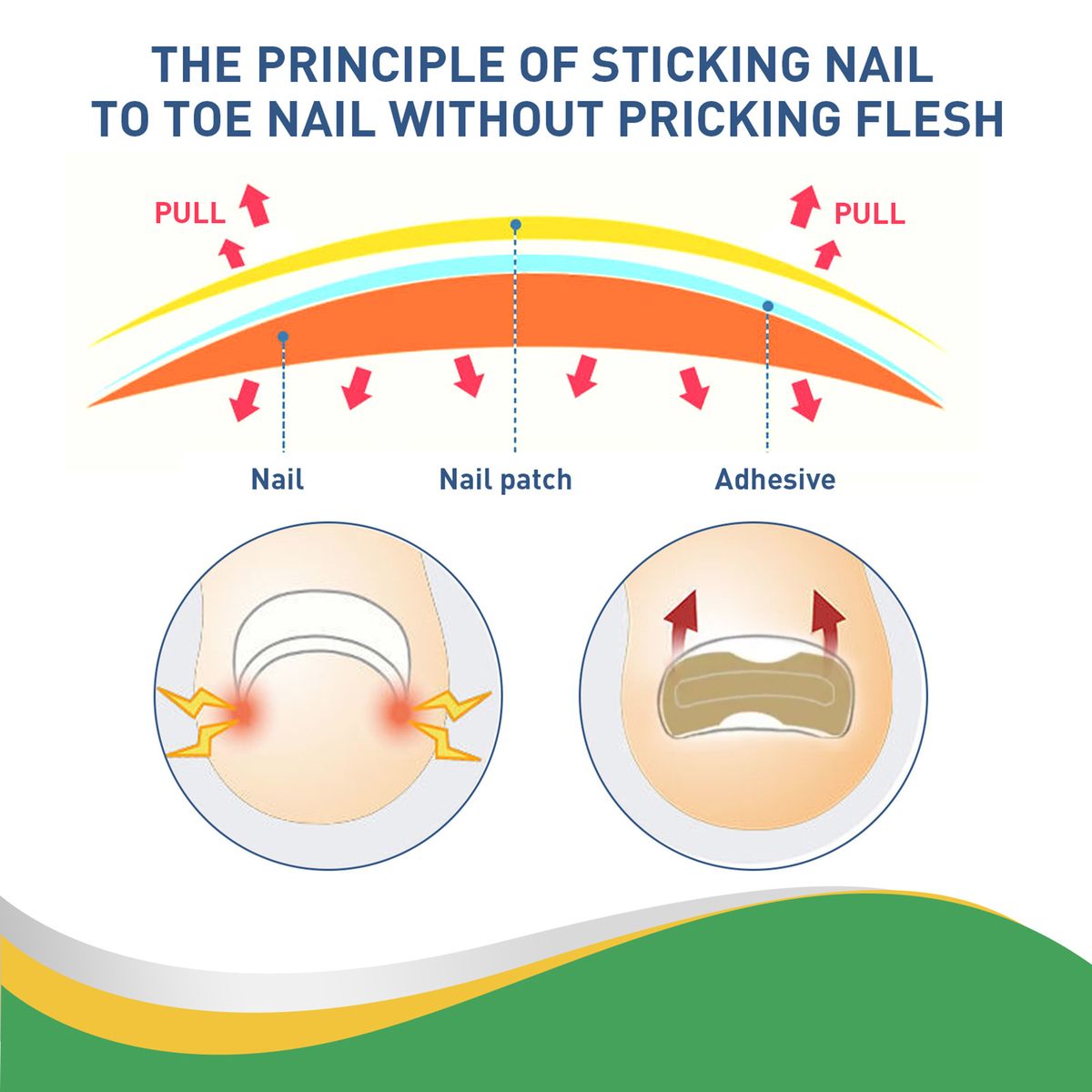50pcs/Box Ingrown Toenail Sticker Toenail
