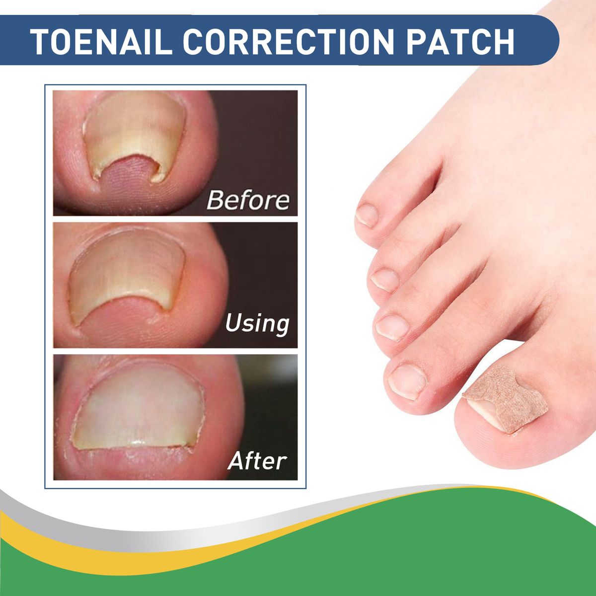 50pcs/Box Ingrown Toenail Sticker Toenail