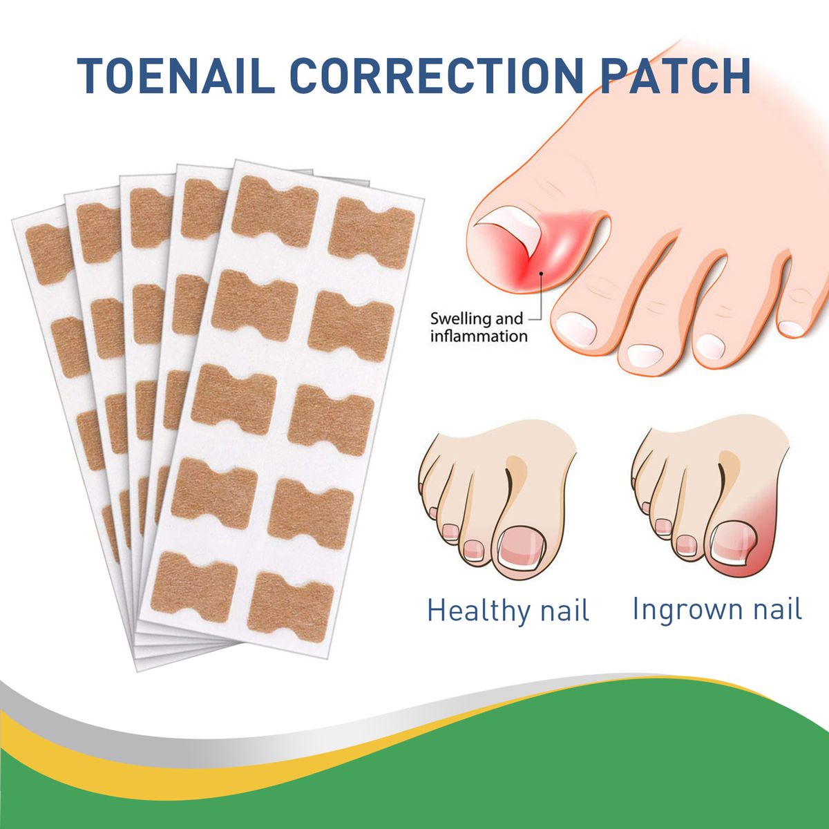 50pcs/Box Ingrown Toenail Sticker Toenail