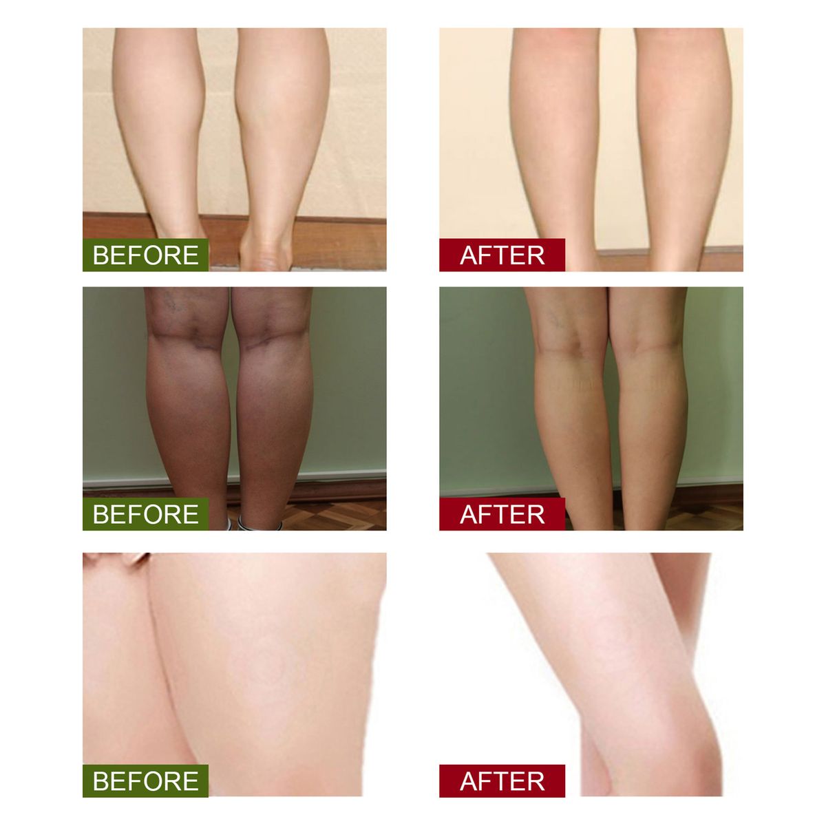 10Pcs Leg Slimming Foot Bath Bags Mild Herbal