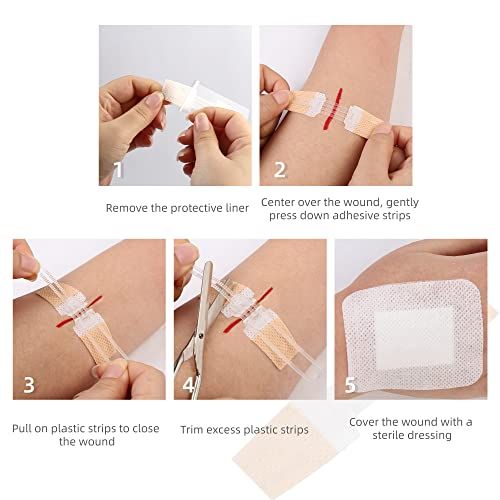 LotFancy Emergency Laceration Closures 4Count Surgical Sutur