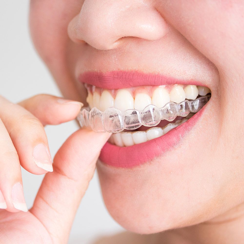 2/4pcs Soft Silicone Tooth Orthodontic S Set Mouth Guard Protector Dental Teeth Ning Trays Retainers Oral Hygiene Care