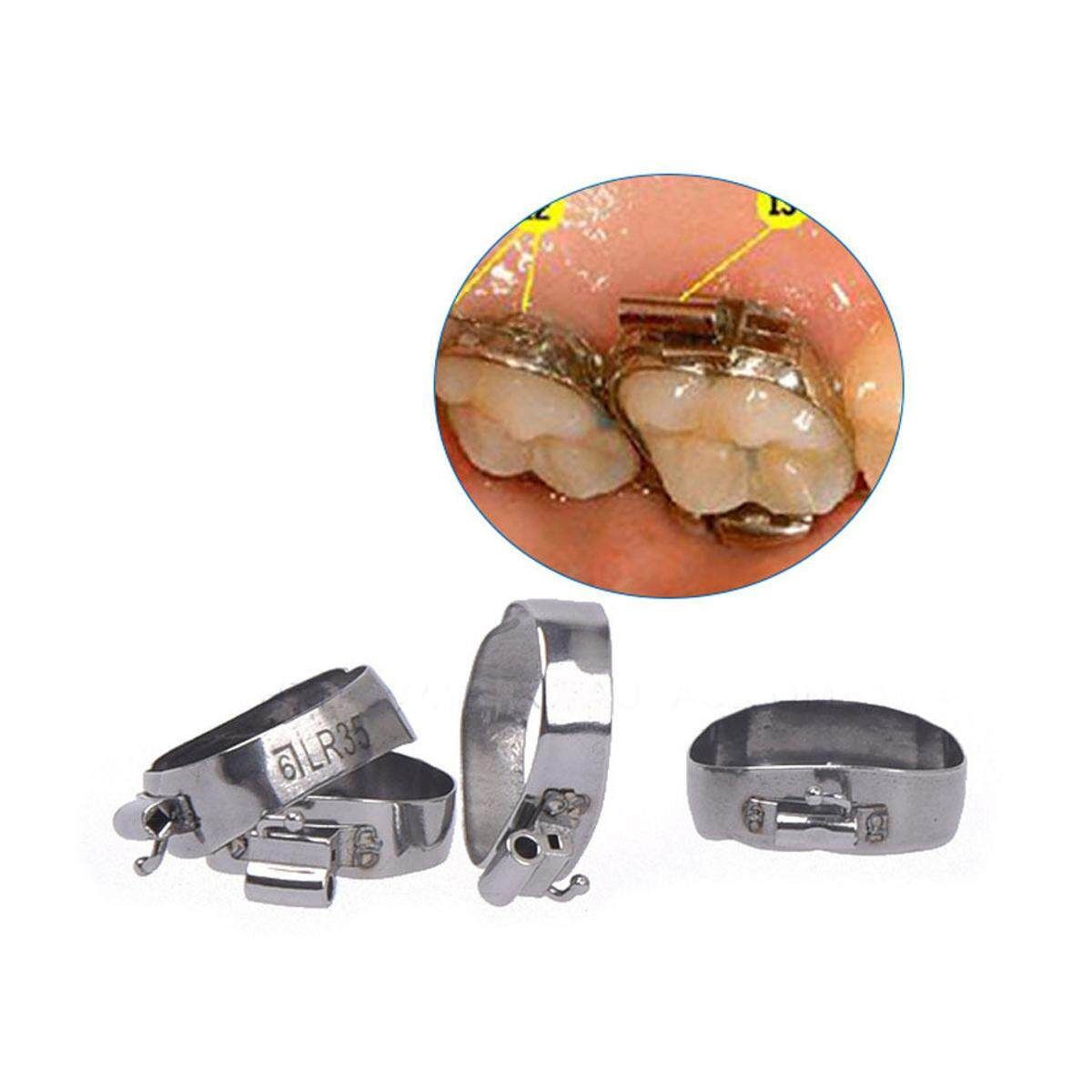 80PCS Orthodontic Dental Molar Buccal Tubes Bands Roth 16#-35# Stainless Steel