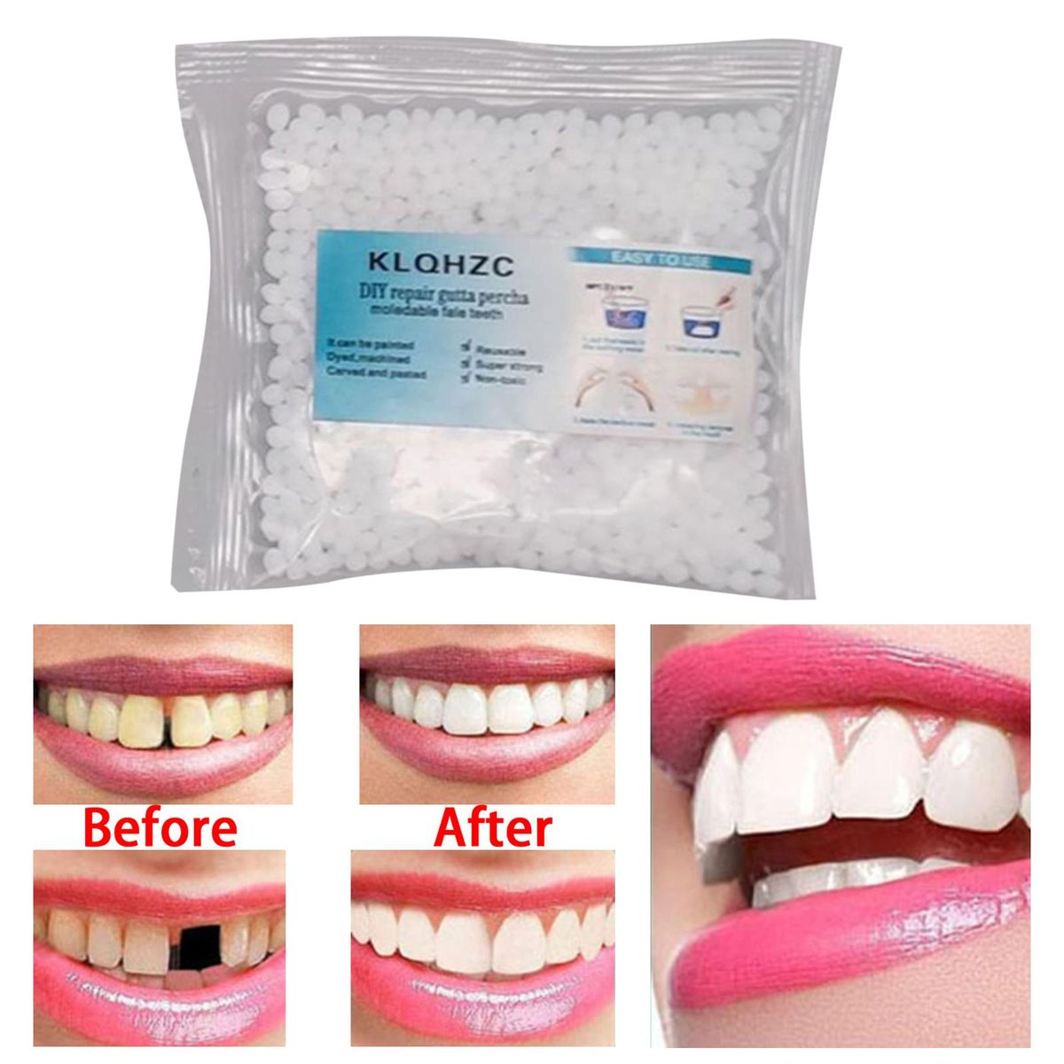 Temporary Tooth Repair  25G Repair Granules 8x8cm