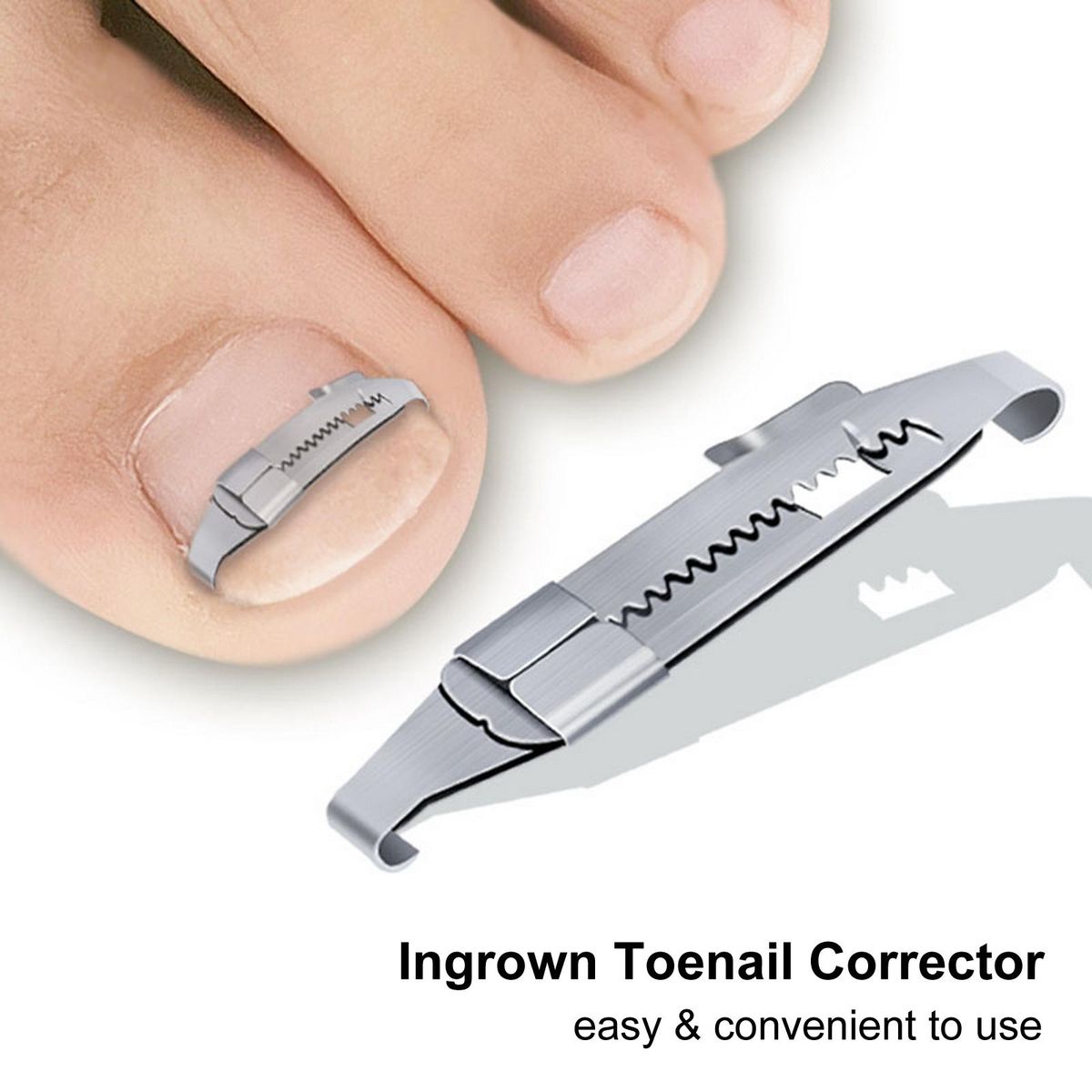 2pcs Ingrown Toenail Corrector Toenail Correction Treatment Tool Foot Nail Care Tool Orthotic Nail Corrector Pedicure Tool
