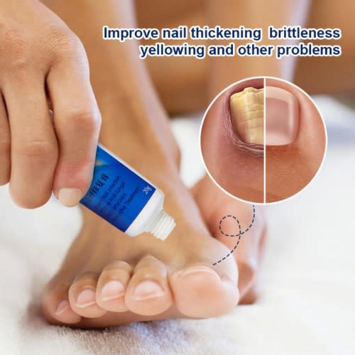 20g Sumifun Nail Fungus Treatment Cream | Nail Infection Cream