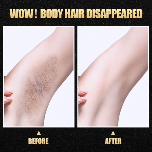 Handle Painless Facial Machine 999999 Flashes Freezing Point Epilator Ipl Laser Hair Removal Device