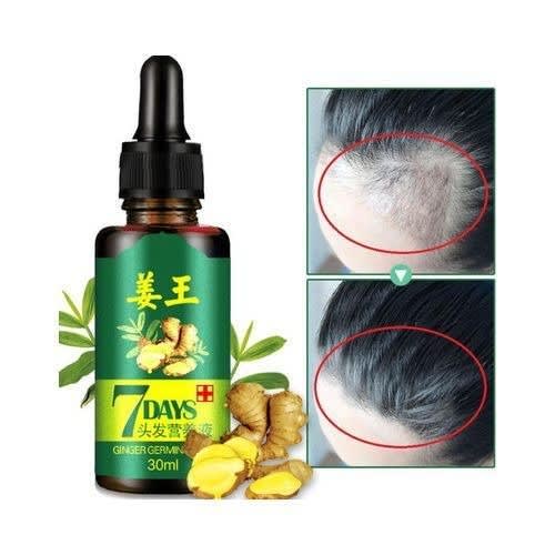 Fast Powerful Hair Growth Essential Oil - Hair Loss Care - 30ml