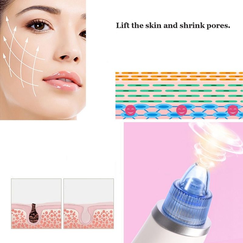 5W Blackhead Remover Pore Cleaning Beauty Device