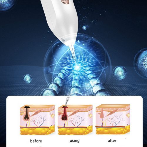Gold Tattoo Freckle Wart Tag Removal Pen Beauty Tools