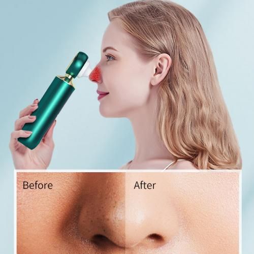 Electric Blackhead Removal Cleaner Magnifier LED Light Face Pore Cleaner