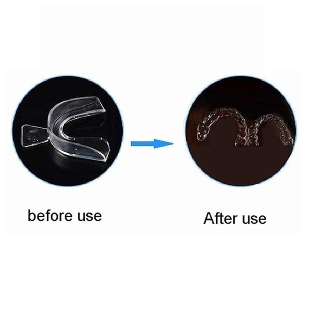 Safety Oral Teeth Clenching Anti Bite Teeth Snore Stop Teeth Grinding Bruxism Teeth Guard Mouthguard Teeth Covers Mouth Guard