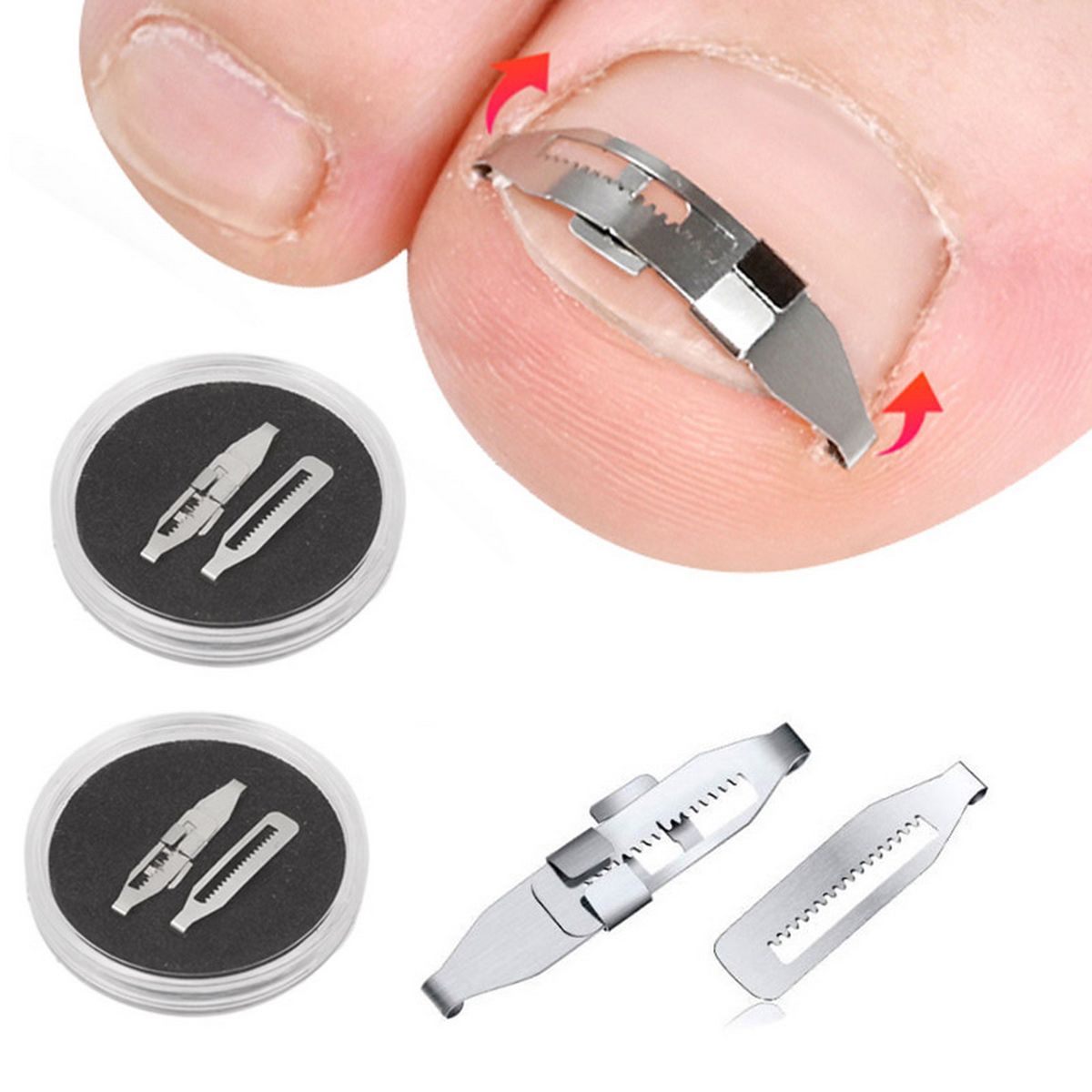 2pcs Ingrown Toenail Corrector Toenail Correction Treatment