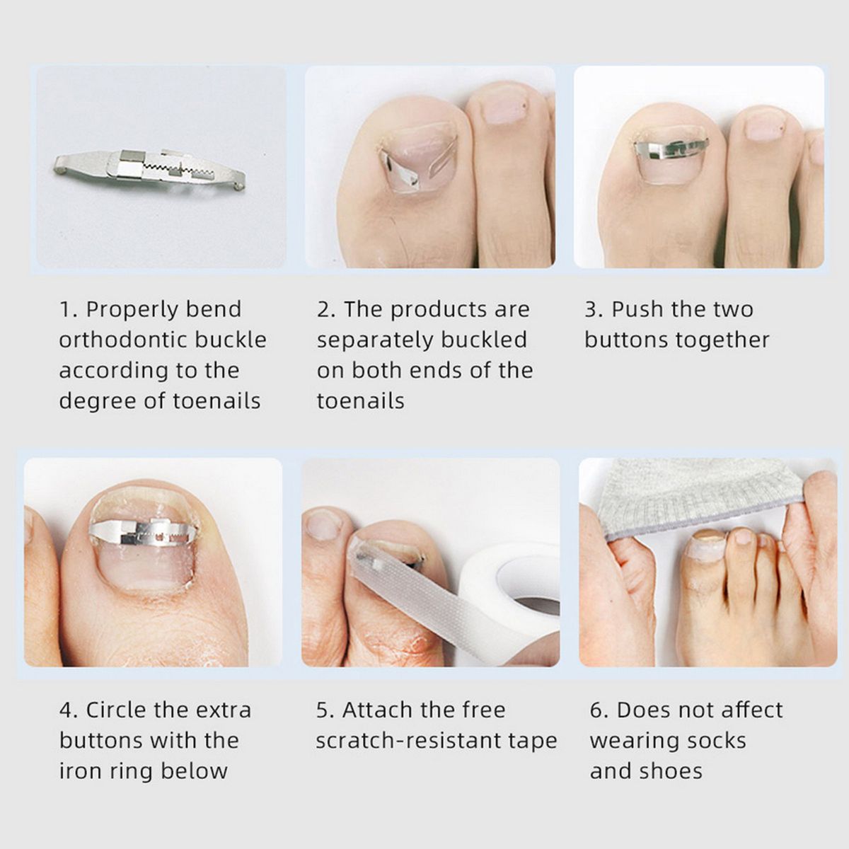 2pcs Ingrown Toenail Corrector Toenail Correction Treatment